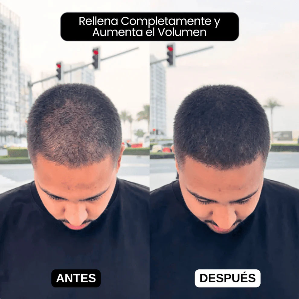 SCULPIX-EL RELLENO CAPILAR MAS VENDIDO