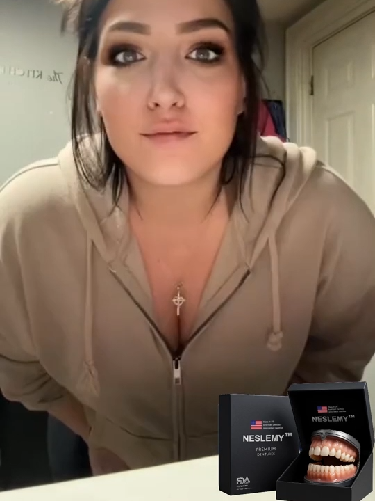 Set de prótesis dentales de soporte esquelético total