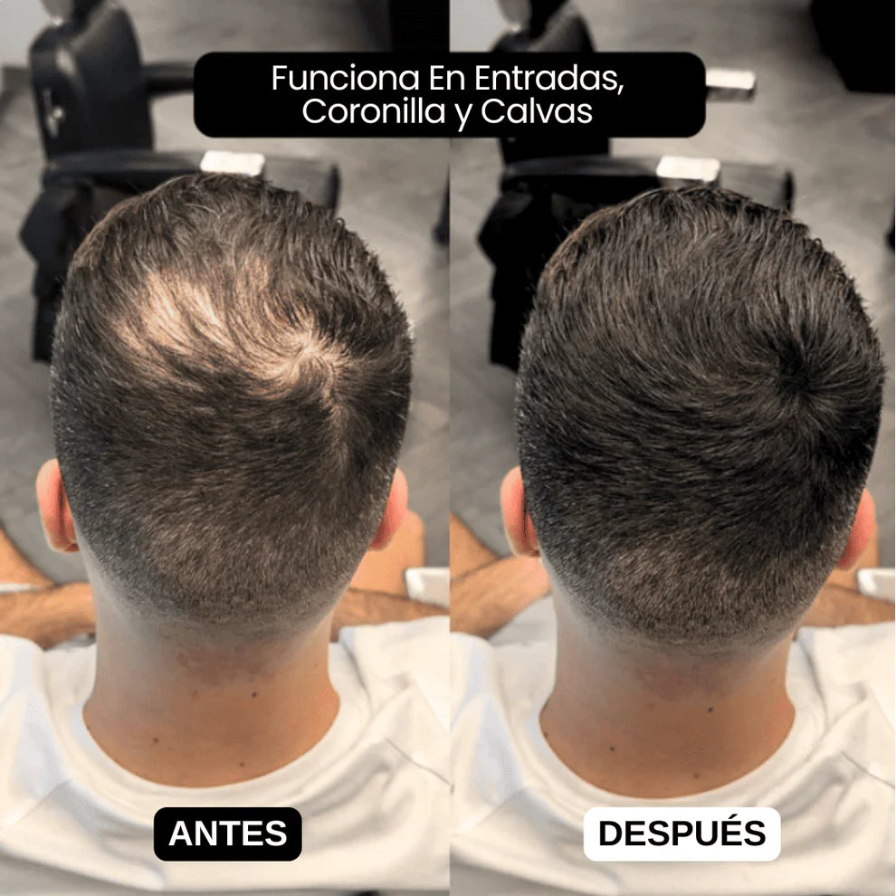 SCULPIX-EL RELLENO CAPILAR MAS VENDIDO