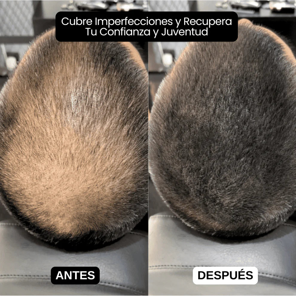 SCULPIX-EL RELLENO CAPILAR MAS VENDIDO