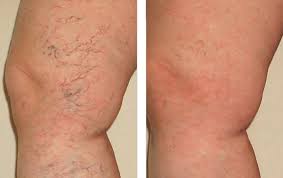 <strong>Yuly G. - Compra verificada</strong>